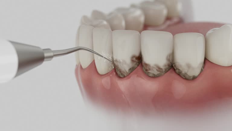 Trusted Teeth Cleaning And Checkup service in Chamblee, GA - Dentist Open Now